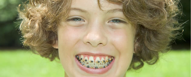 cheap-orthodontist-in-san-diego